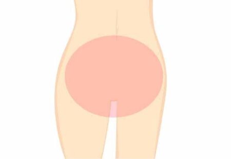 vio ざっくり位置　図解1
